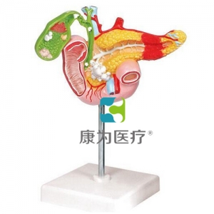 “康為醫療”病理模型胰腺模型，十二指腸和膽囊模型
