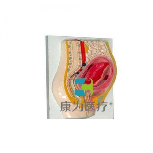 “康為醫療”胎盤剝離模型