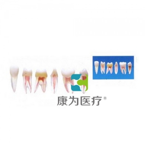 “康為醫療”帶髓腔牙齒模型