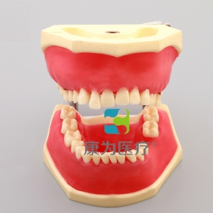 “康為醫療”牙周病模型