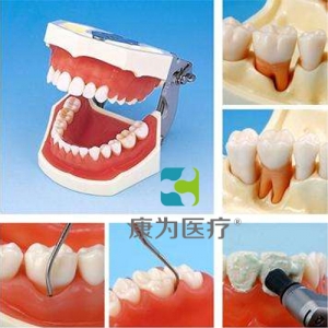 “康為醫療”牙周外科實習用牙列模型