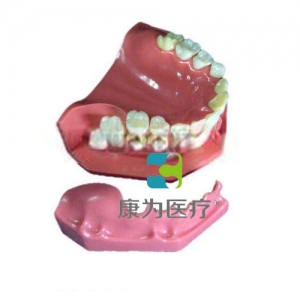 “康為醫療”牙列發育模型A
