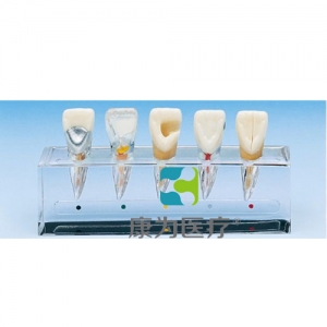 “康為醫療”臨床牙髓病模型