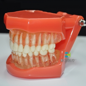 “康為醫療”軟牙齦可拔牙模型（斜板）