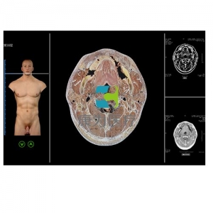 “康為醫療”斷層解剖與斷層影像虛擬教學系統